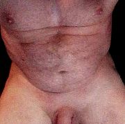 Advaidi1408 - мужчина, 31 лет, Kalisz