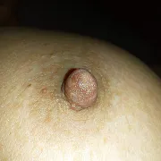 Niedlakazdego