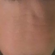 Botoks2000 - mężczyzna, 44 lat, Zgorzelec