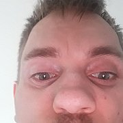 Dawida1 - чоловік, 21 років, Łobżenica