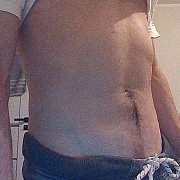 Tylkodzis