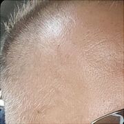 10505 - mężczyzna, 32 lat, Poznań