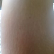 Ani69 - kobieta, 34 lat, Bielsko-Biała