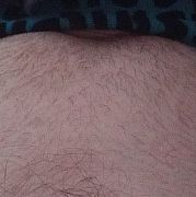 Lekarstwo - muž, 39 let, Kraków