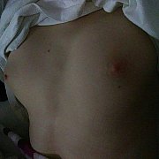 Onionisad - pár (žena 21 let, muž 22 let), Szczecin