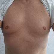 SCT503 - man, 47 years, Opole