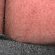 Jebanko699 - мужчина, 30 лет, Koszalin