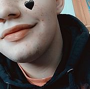 Ostry02 - muž, 23 let, Bełchatów