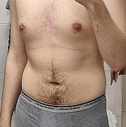 MlodyB - чоловік, 20 років, Warszawa