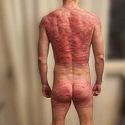 Postpain - mężczyzna, 40 lat, Rajgród