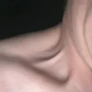 ProstyJhony420