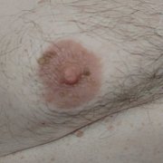 Drops1 - mężczyzna, 60 lat, Zalewo