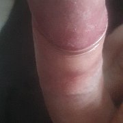 Zwyklykolo049 - чоловік, 31 років, Poznań