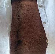 Zonatybi69