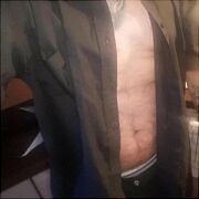 NormalnaParaXXX