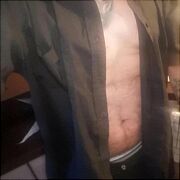 NormalnaParaXXX