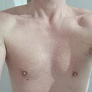 P10 - mężczyzna, 37 lat, Śrem