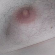 20167 - mężczyzna, 76 lat, Katowice