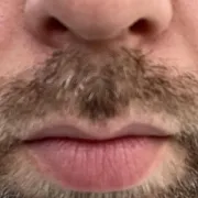 Misiowy