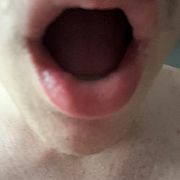 Lodzikzspustem - mężczyzna, 19 lat, Jastrzębie-Zdrój