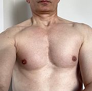 PPIE - mężczyzna, 54 lat, Aberdeen