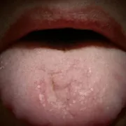 SSSAKKKPASSS