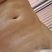 Stalma44