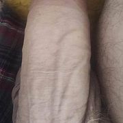 Ostra1 - man, 49 years, Cheltenham