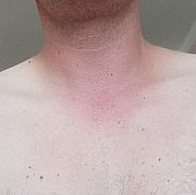 Zadlugosamotnytomasz - mężczyzna, 35 lat, Bielsko-Biała