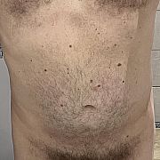 Poziom - mężczyzna, 48 lat, Gdańsk