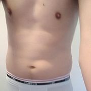 Phtr200 - mężczyzna, 43 lat, Bydgoszcz