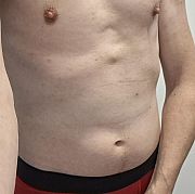 Phtr200 - mężczyzna, 43 lat, Bydgoszcz