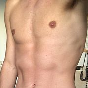 Lukas232 - mężczyzna, 23 lat, Lublin