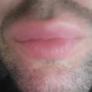 Piotrek1992111 - mann, 33 Jahre, Głogówek