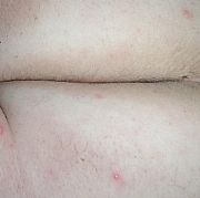 NYPD35 - mężczyzna, 35 lat, Częstochowa