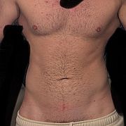 NaturalnyAdi - mężczyzna, 21 lat, Białystok