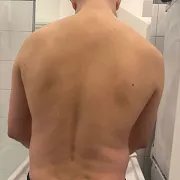 Xtopp