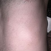 PrawdziwaMILOSC - чоловік, 32 років, Łódź