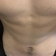 Normalnyemocjonal - чоловік, 20 років, Ostrów Wielkopolski