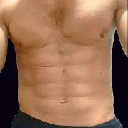 Zotycris277