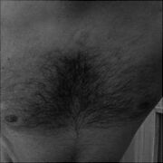 Oral1234