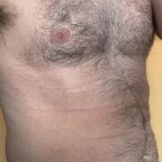 Staug1 - muž, 45 let, Gorlice