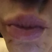 EperoRafal