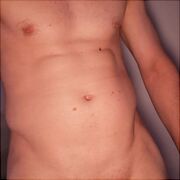 Dickk18cm