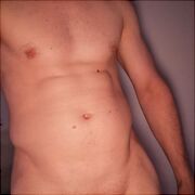 Dickk18cm