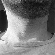 NapalonyRogacz