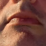 OnMatkrk